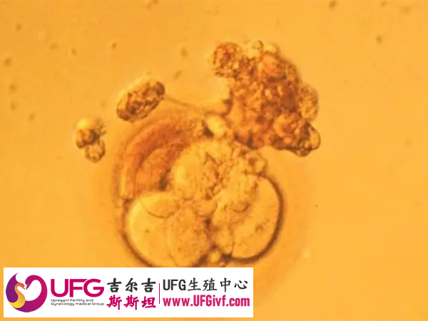 4AA和4BB的区别在质量等级上