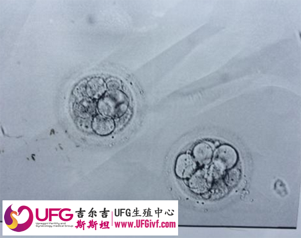 囊胚活检淘汰率是由胚胎的质量决定