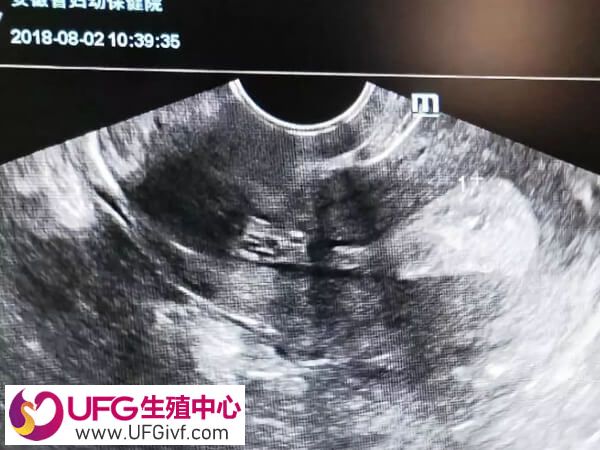 移植前内膜变薄还能不能补救