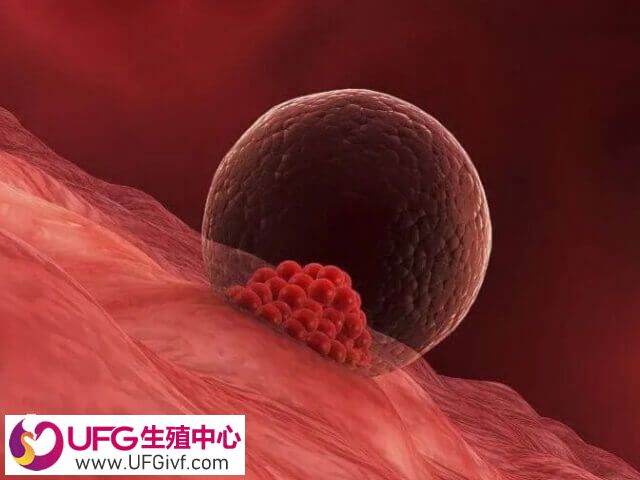 试管移植后能不能穿紧身裤