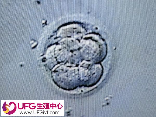 试管二次移植冻胚收费低